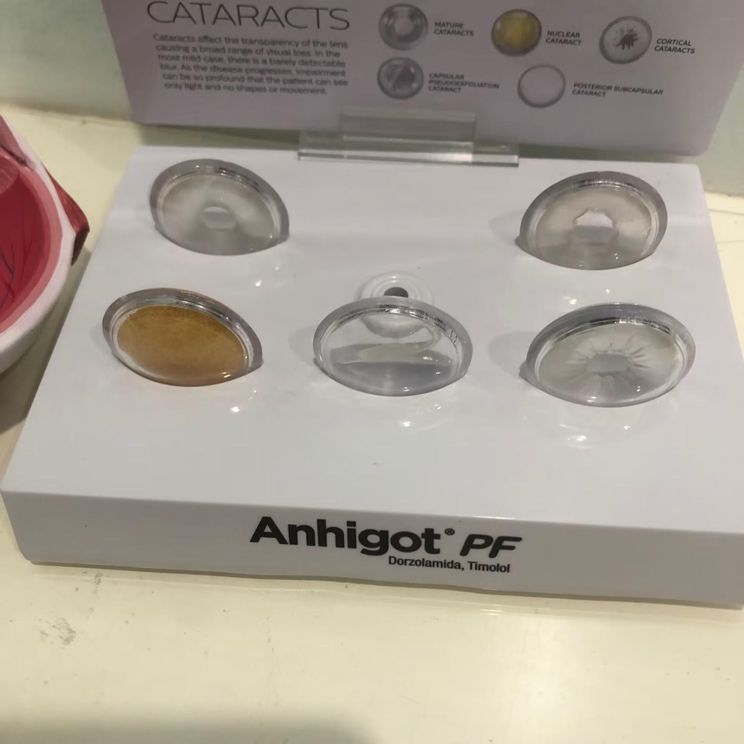 Science Exhibition Models - 眼模型 白内障眼模型、教育実験医学解剖模型 眼科クリニック展示